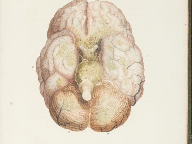 The Morbid Anatomy of the Human Brain; Being Illustrations of the Most Frequent and Important Organic Diseases to Which That Viscus Is Subject