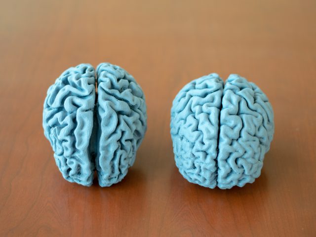 3D-Printed Healthy Human Brain
