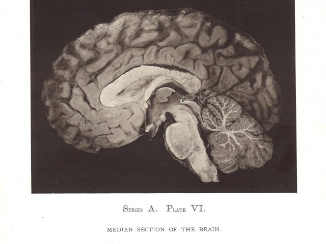 Topographical Anatomy of the Brain